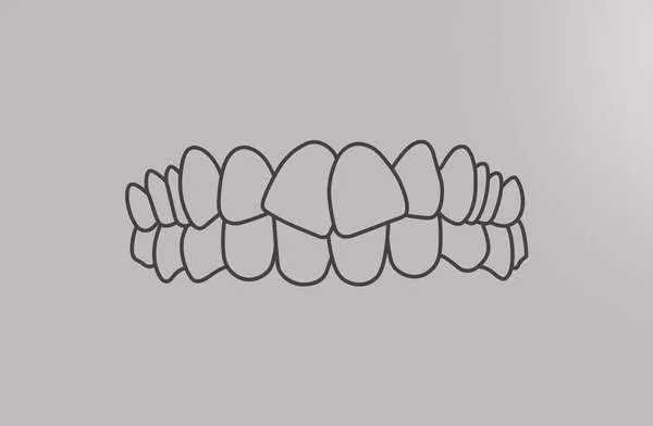 Close-up of a smile with crooked teeth