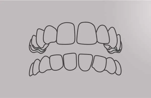 Close-up of a smile with gap teeth