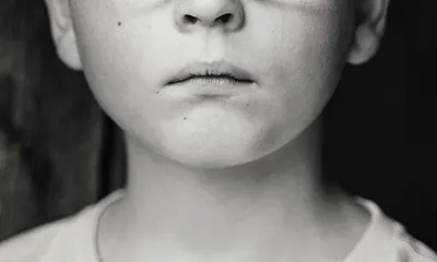 Sad child with a toothache